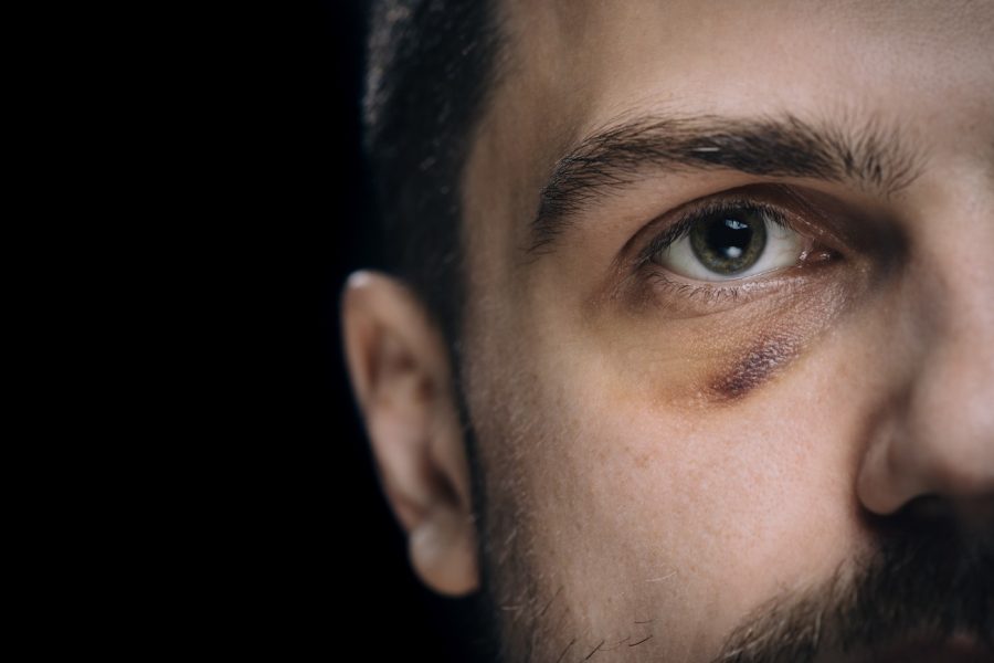 Male Victims of Domestic Violence